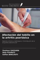 Zouhour Gassara (U. A.) | AfectacióN Del Tobillo En La Artritis PsoriáSica