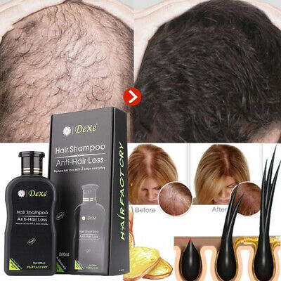 Champu Remedio Para La Caida Del Cabello Y Estimular Crecimiento