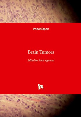 Amit Agrawal | Brain Tumors | Buch | Englisch (2022) | Gebunden | IntechOpen