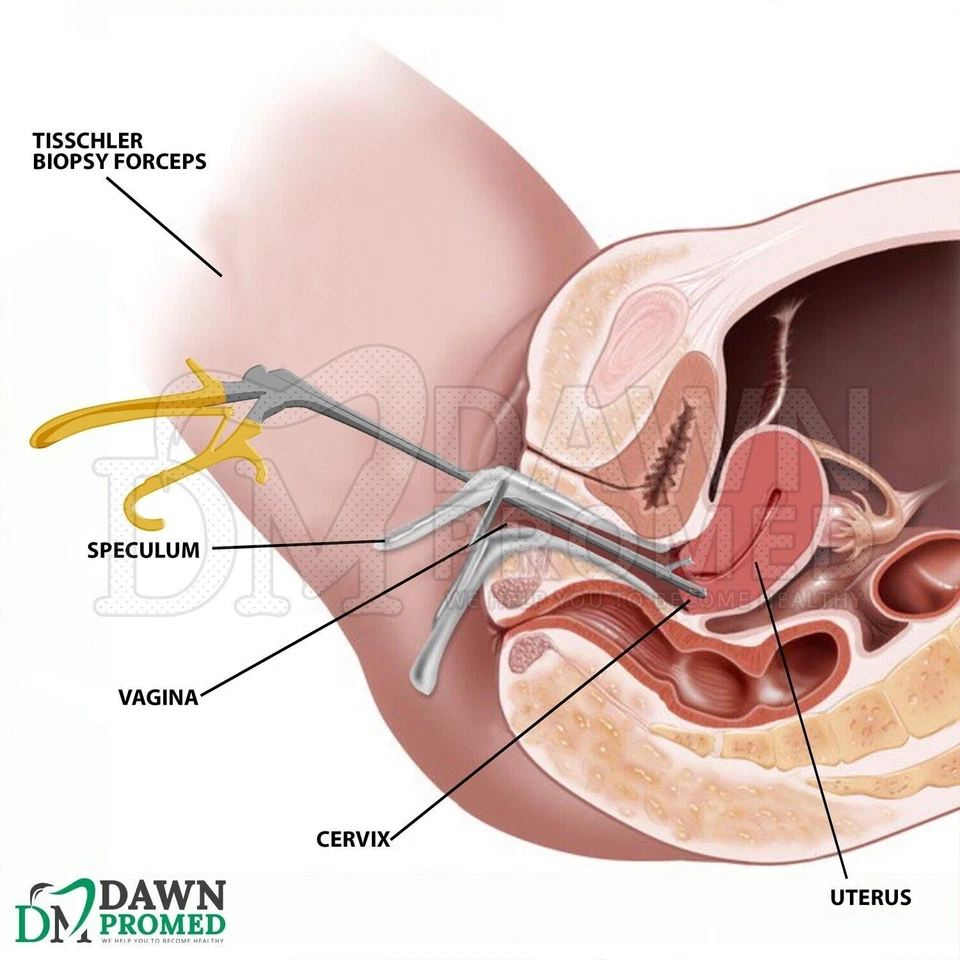 Burke Baby Tischler Biopsy Punch Forceps 4.5 X 3 X 1.5 mm Bite OB/GYN German Gr - image 4 of 4