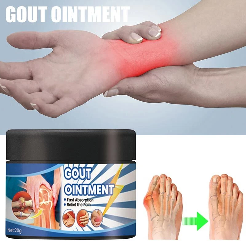 Urigone Healing Ointments for Gout Bunion Arthritis Knee Joint Pain Relief Cream