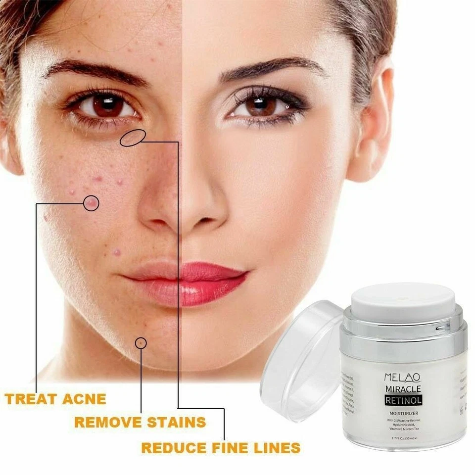 Crema de retinol 2,5 % vitamina E + ácido hialurónico AHA arrugas orgánicas antienvejecimiento  Foto 2 de 4