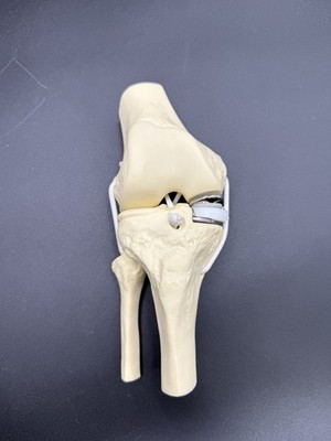 Life Size Flexible Knee Joint Surgery Replacement Anatomical Demonstration Model