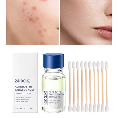 Salicylic Acid Acne Treatment Drying Lotion Anti-Acne Blemishes 10 ml * 1-4 pack