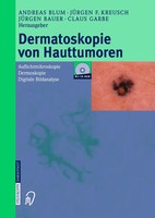 Dermatoskopie Von Hauttumoren | A. Blum (U. A.) | Taschenbuch | Xvi | Deutsch