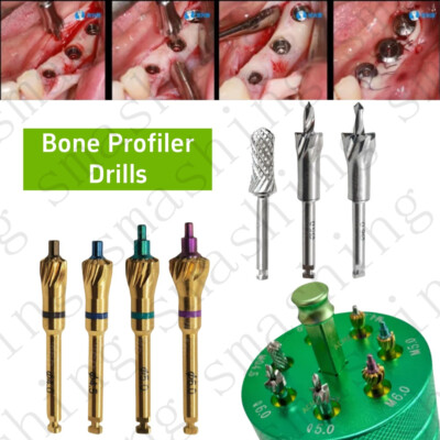 Dental Implant Bone Profiler Ridge Contouring Drills Trimmer Collector ...