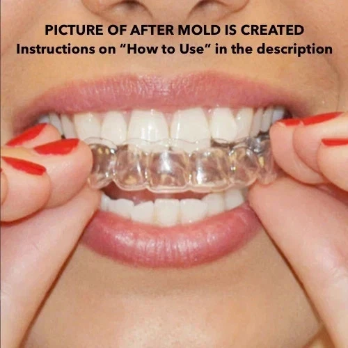 Teeth Whitening Mouth Trays Remouldable Gum Shields Easy Moulds Tooth Bleaching