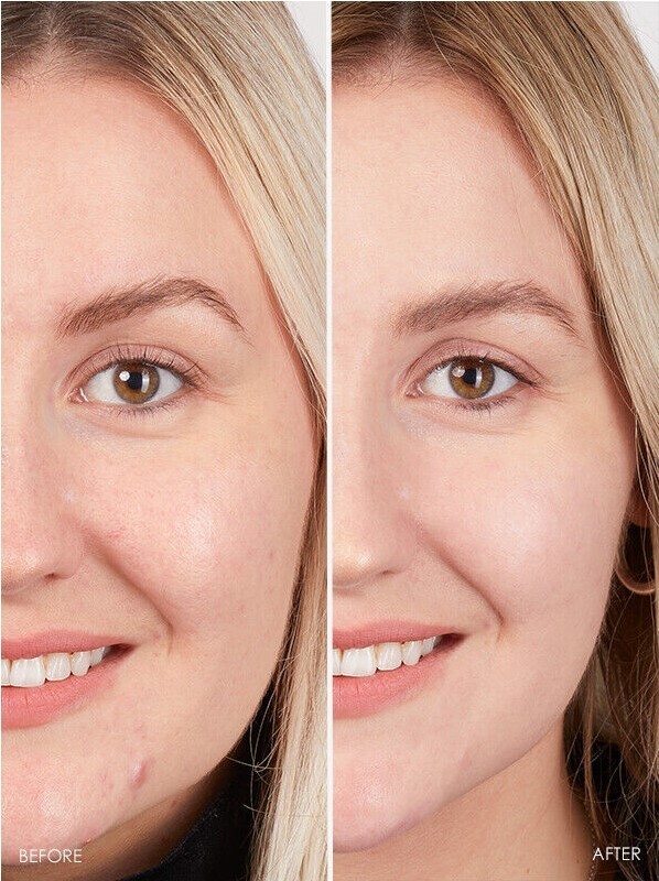 Peptide Cream Hyaluronic Acid ha Wrinkle Intense Collagen Face, Body Firming