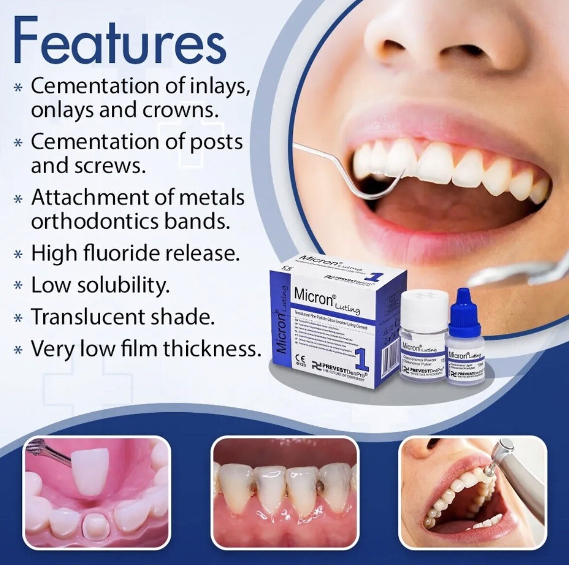 Tooth crown repair, bridge repair, veneer fix glue DIY permanent cement