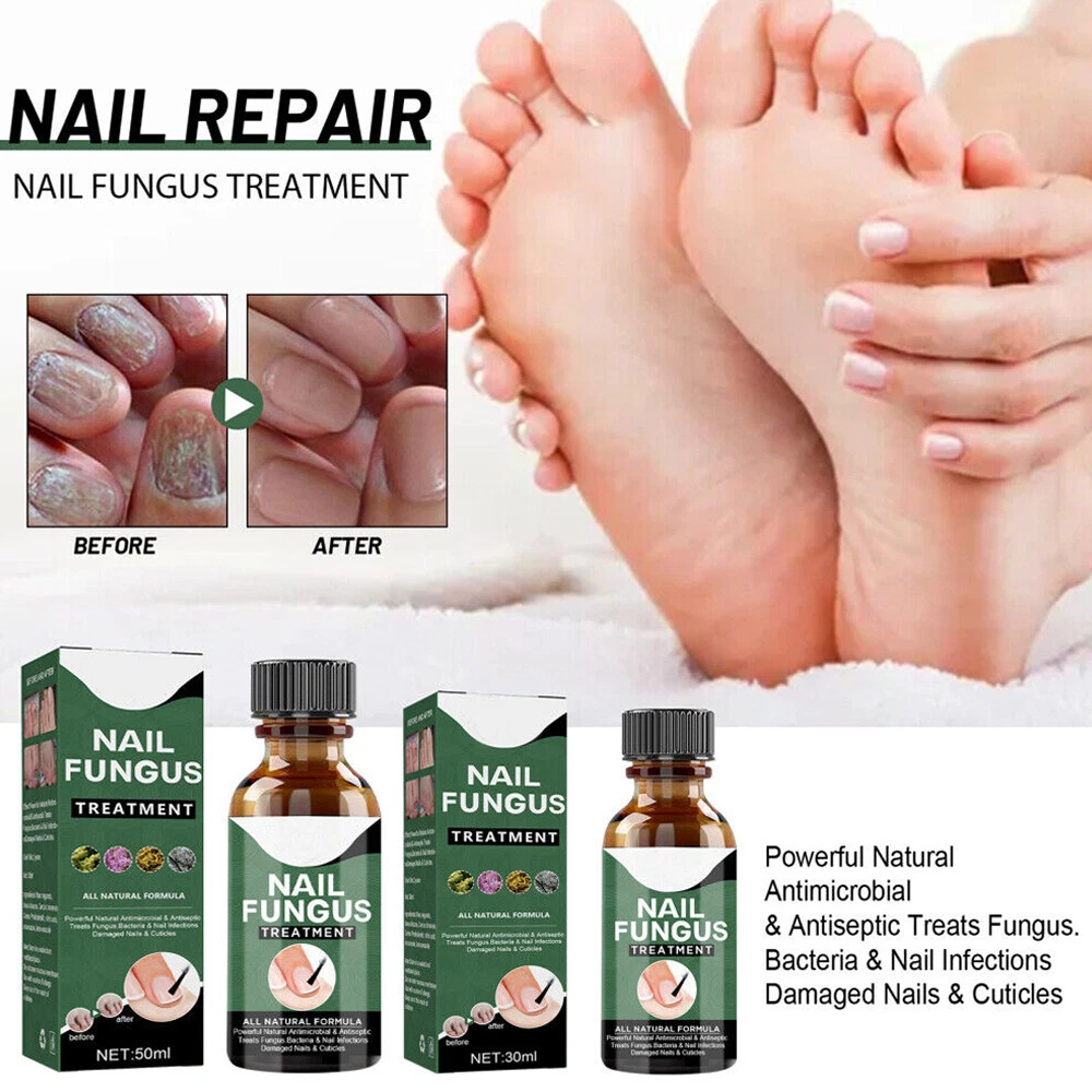 How YJT Nail Fungus Laser Therapy Clip Cure Finger and Toe Germ