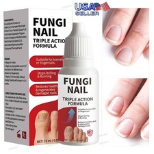 Fungi-Nail Anti-Fungal Liquid Solution Kills Fungus That Can Lead To Nail