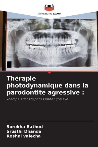ThéRapie Photodynamique Dans La Parodontite Agressive : Roshni Valecha-image