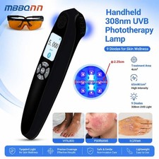 Handheld 308nm Home UVB Phototherapy Device 9 Diodes for Skin Care and Wellness