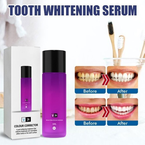 v34 whitening