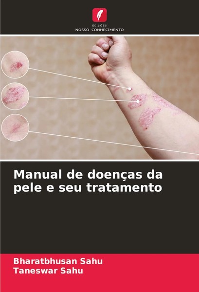 Bharatbhusan Sahu (U. A.) | Manual De DoençAs Da Pele E Seu Tratamento | Buch-image