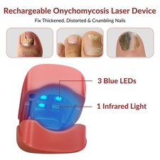 Nail Fungus Laser Therapy Device 460nmx3 905nmx1 Onychomycosis Treatment Home
