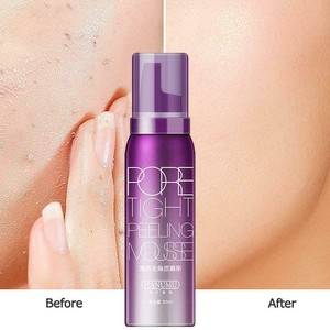 skin tight after cleansing