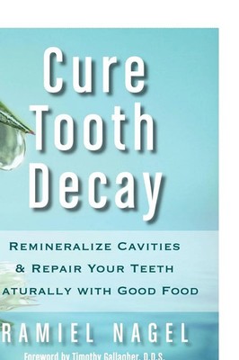 Cure Tooth Decay Ramiel Nagel Taschenbuch Kartoniert / Broschiert Englisch 2010