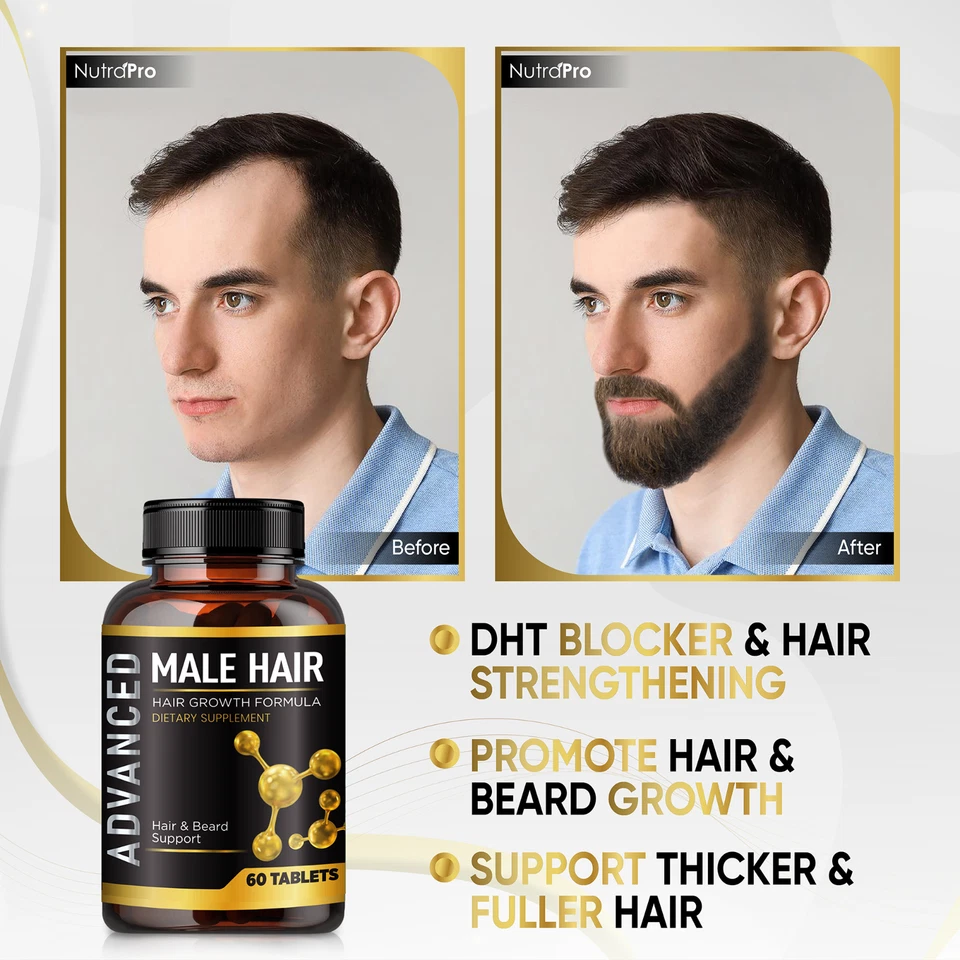 Vitaminas para el crecimiento del cabello para hombres-antipérdida de cabello vitaminas de apoyo píldoras y bloqueador de DHT Foto 3 de 4