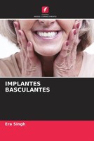 Era Singh | Implantes Basculantes | Taschenbuch | Portugiesisch (2022)
