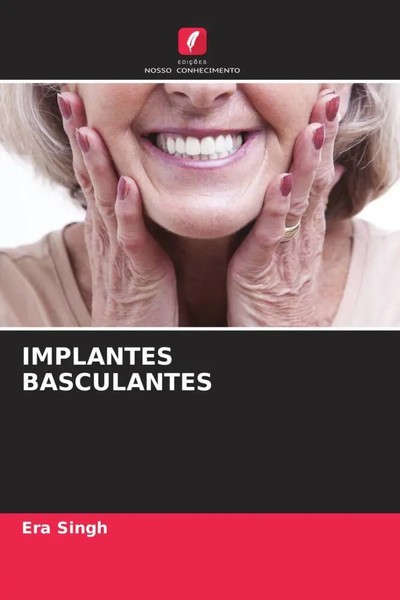 Era Singh | Implantes Basculantes | Taschenbuch | Portugiesisch (2022)-image