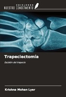TrapeciectomíA Krishna Mohan Lyer