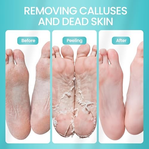 Foot Peeling Mask for Dead Skin Remover & Deep Moisturize | 2 Pairs Aloe Vera 