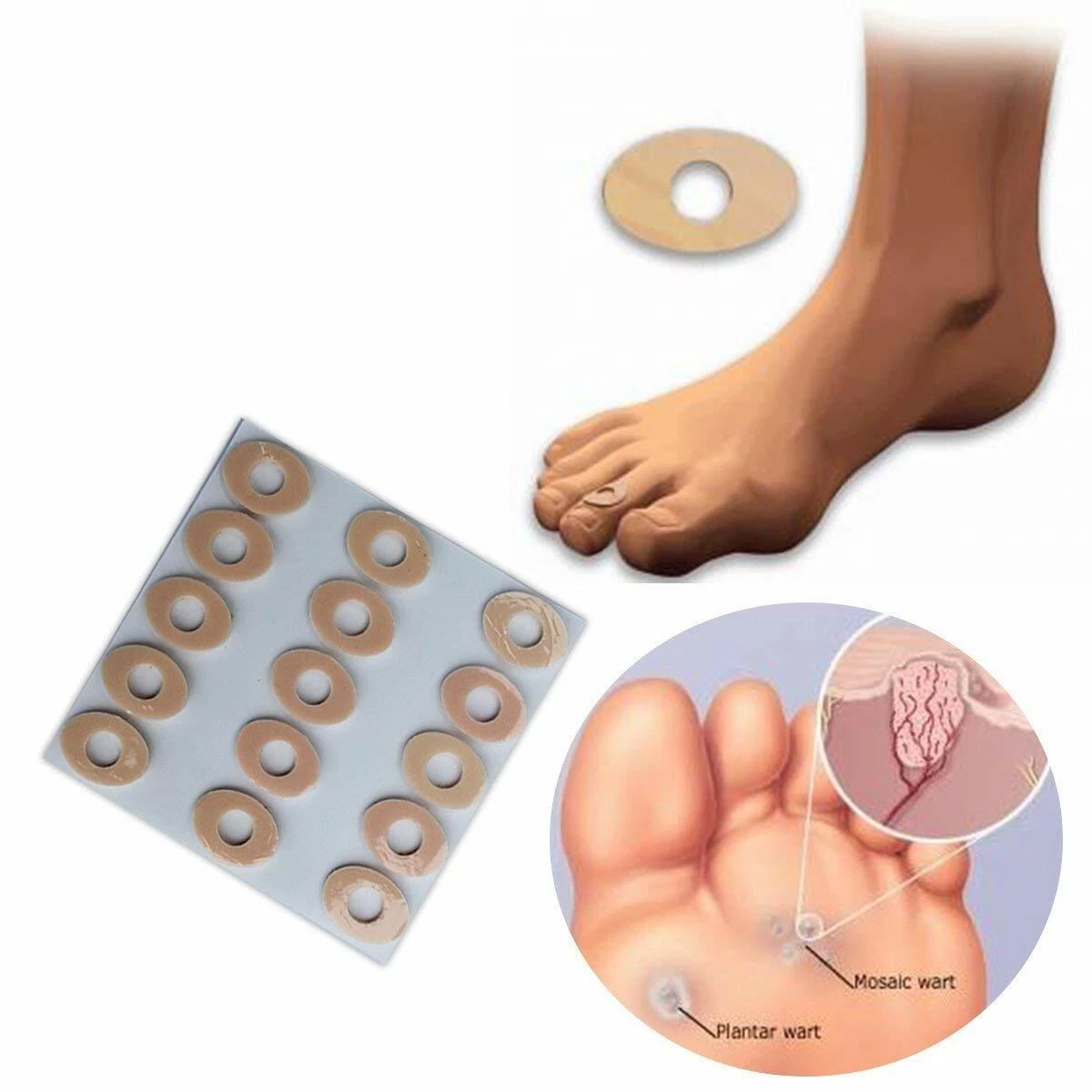 Corn pads for between toes 2025