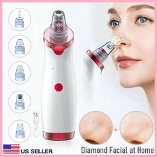 Blackhead Remover Vacuum Diamond Face Cleaner Pore Vacuum Suction White Heads