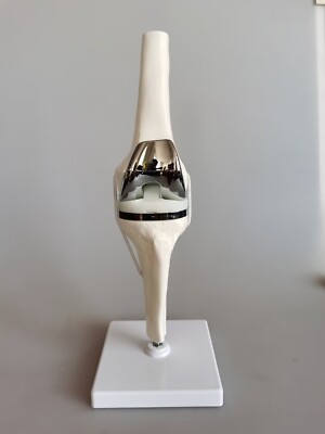 1:1 Artificial Knee Joint Medical Anatomical Skeleton Demo Display Model