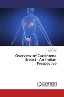 Sameer Gupta (U. A.) | Overview Of Carcinoma Breast - An Indian Prespective