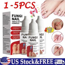 1-5PC Fungi-Nail Anti-Fungal Liquid Solution Kills Fungus That Can Lead To Nail