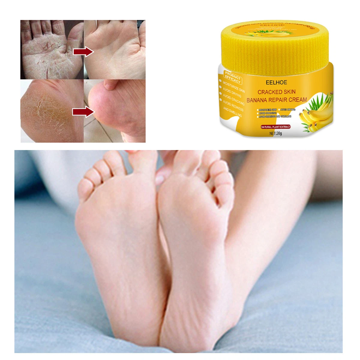 How to Remove Dead Skin from Feet: 7 Methods to Try