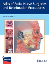 Atlas of Facial Nerve Surgeries and Reanimati...