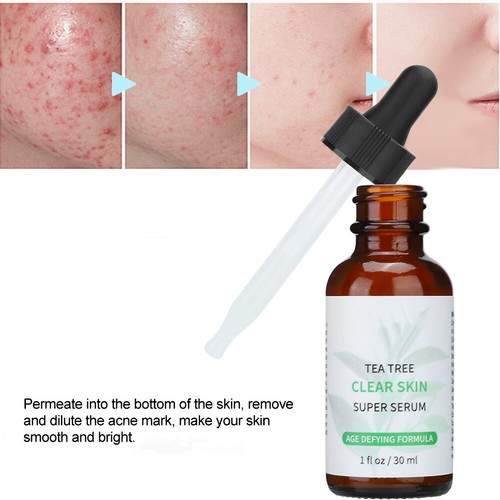 30ml Tea Tree Oil Facial Serum Face Moisturizing Oil Control Shrink Remove Serum - Afbeelding 6 van 10