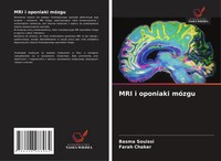 MRI I Oponiaki MóZgu Basma Souissi (U. A.) Taschenbuch Englisch 2025