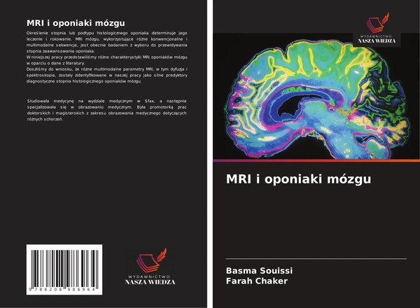 MRI I Oponiaki MóZgu Basma Souissi (U. A.) Taschenbuch Englisch 2025-image