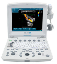 Edan U50 Portable Ultrasound