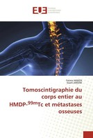 Fatma Hamza (U. A.) | Tomoscintigraphie Du Corps Entier Au Hmdp-99Mtc Et...