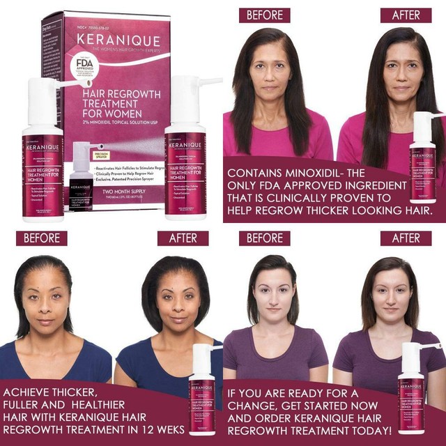 Keranique Hair Regrowth Treatment for Women 2 Month Supply for sale online  | eBay