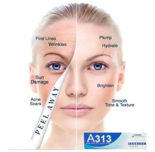 A313 Retinol Pommade, Vitamin A 200.000 UI - Anti Aging 50g New in Box - Bild 3 von 5