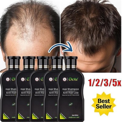 5/3pc DEXE Anti-Hair Loss Shampoo Chinese Herbal Hair Regrowth Men & Women 200ML