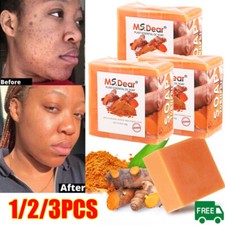 3/1x Tumeric Soap Skin Whitening Dark Spots lightening Acne Brightening Turmeric