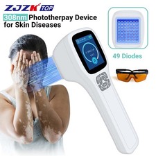 308nm UV Phototherapy Light Therapy Lamp for Allergies Home Handheld 49 Diodes