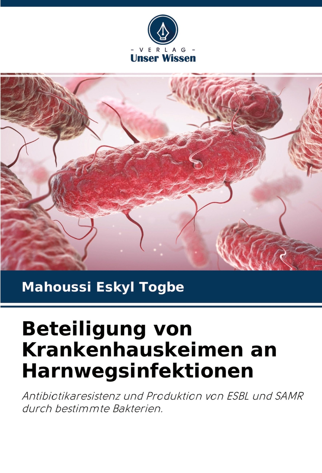 Beteiligung Von Krankenhauskeimen An Harnwegsinfektionen Mahoussi