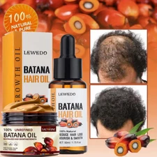Natural Batana Oil Serum For Hair Growth Healthier Thicker Fuller Anti Hair Loss