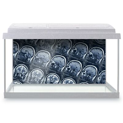 Aquarium Hintergrund 90x45cm - MRT Gehirn Scan Röntgenbilder #21920
