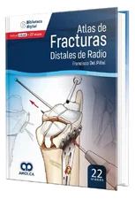 Atlas de Fracturas Distales de Radio By Francisco Del Piñal