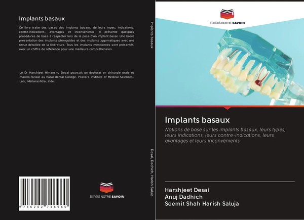 Implants Basaux Harshjeet Desai (U. A.) Taschenbuch FranzöSisch 2020-image