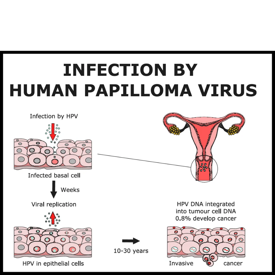 TERAPIA DE HIERBAS NATURALES PARA BACTERIAS STI MUJERES Y HOMBRES - 120 CÁPSULAS - HECHO EN EE. UU. Foto 2 de 4